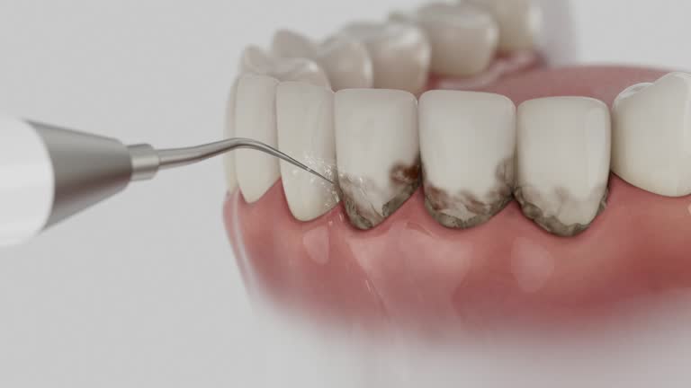 Trusted Teeth Cleaning And Checkup service in Des Plaines, IL - Dentist Open Now
